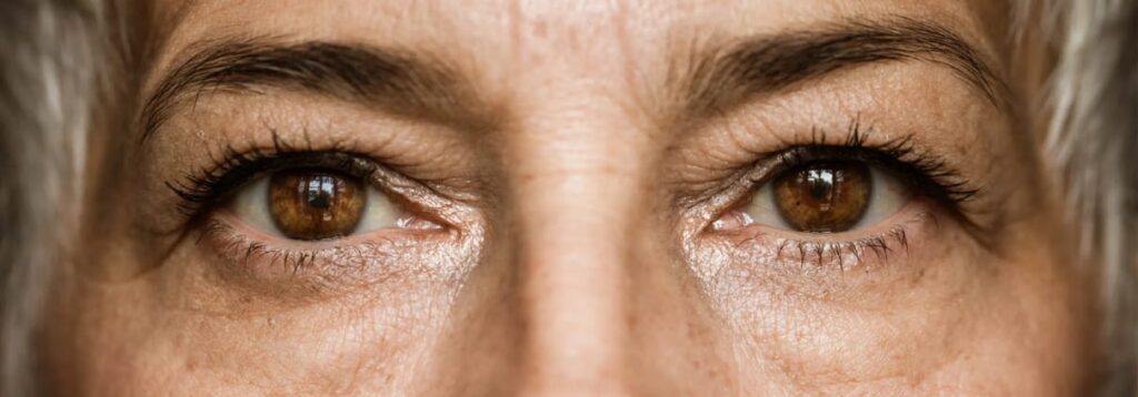 Cataract eye surgery in Delhi