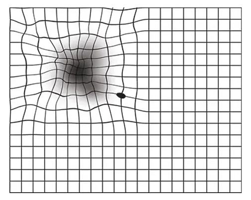 Amsler grid seen by patients of ARMD