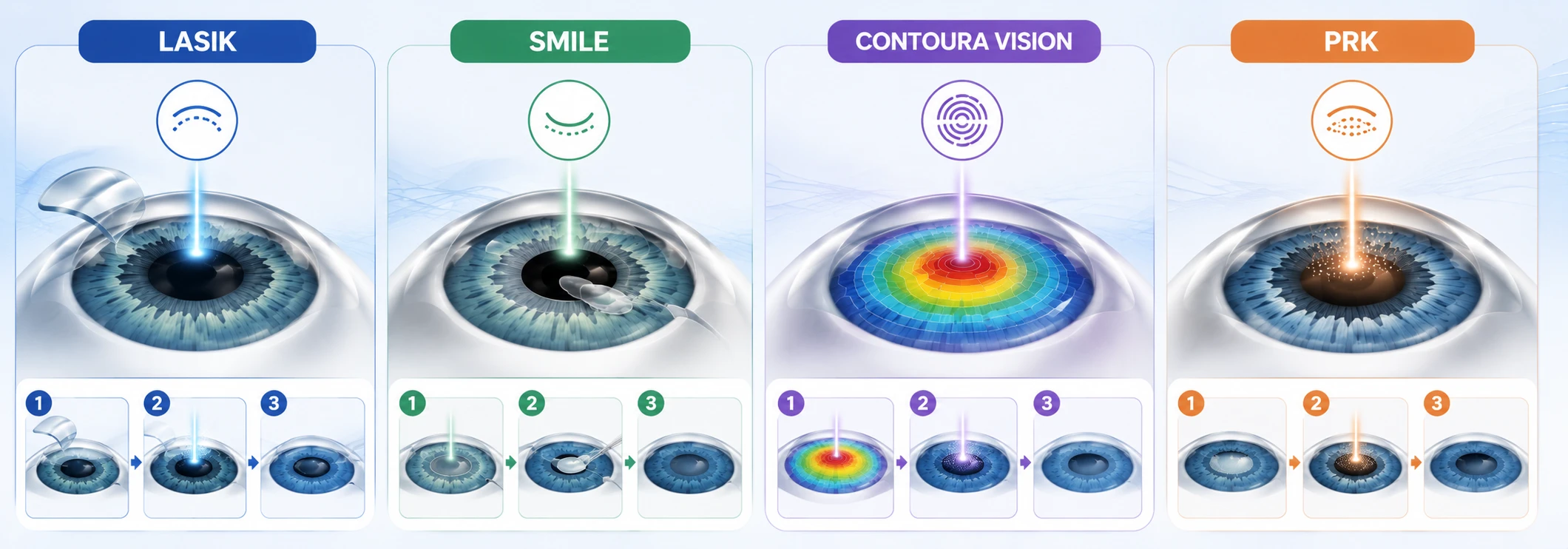 LASIK vs SMILE vs Contoura Vision vs PRK